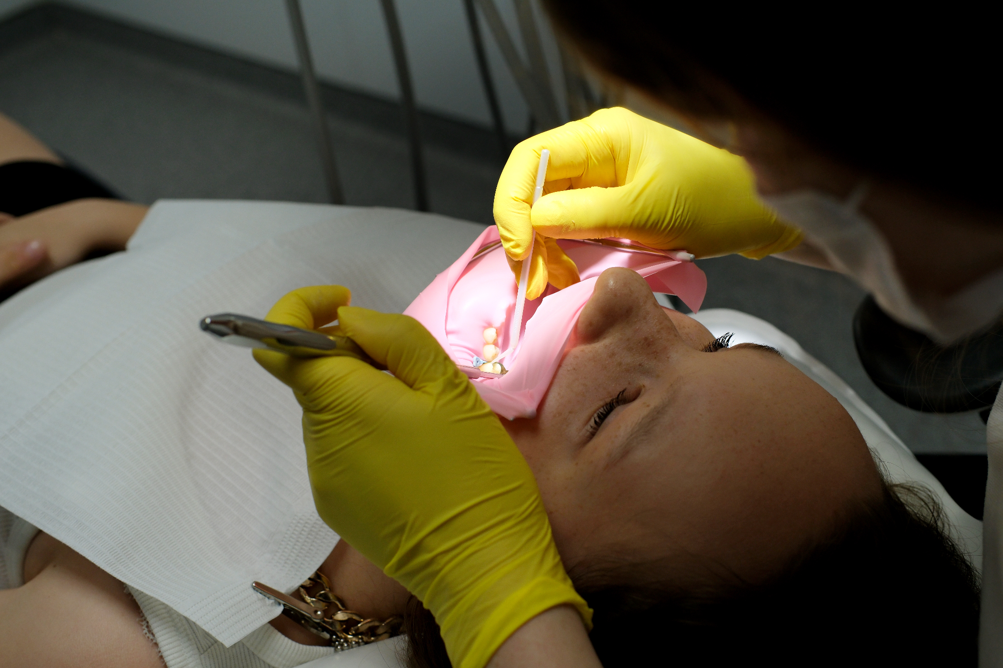 Endodontija me je precej prestrašila